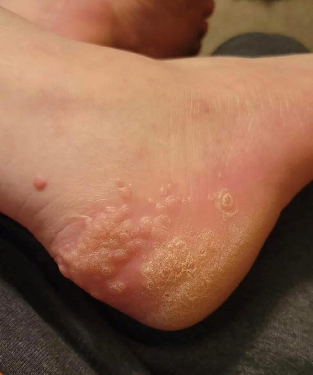 These Are the Consequences of Wearing Used Shoes A Small Mistake That Can Leave a Painful Mark