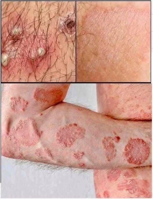 These are the consequences of sleeping with the…See more