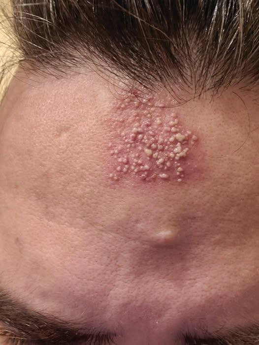 HT1. The Real Consequences of Sleeping With…See More