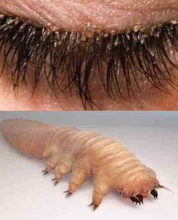 How To Spot Eyelash Mites