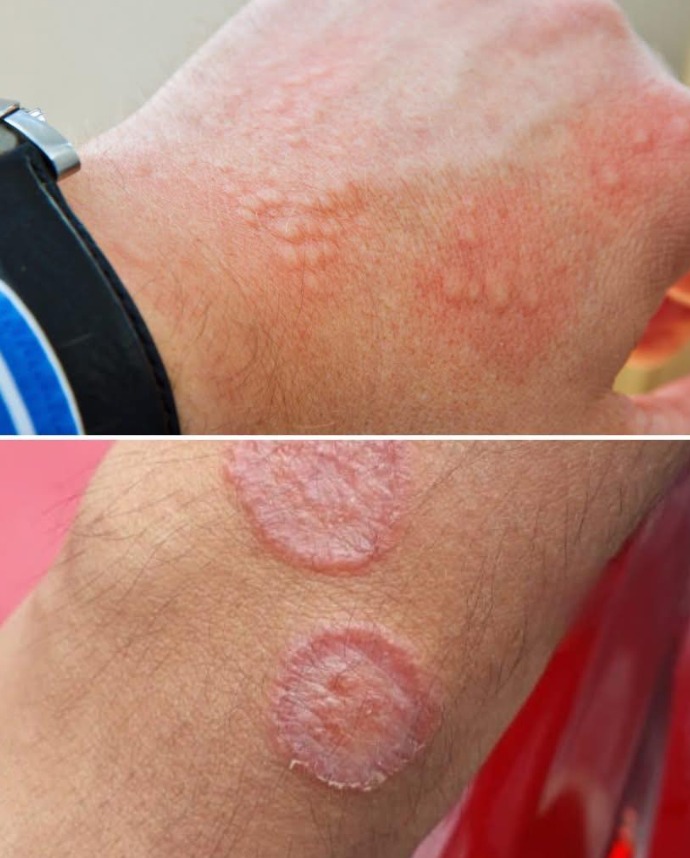 What Your Skin Could Be Telling You About Hidden Health Issues