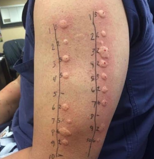 These are the consequences of sleeping with the… See more