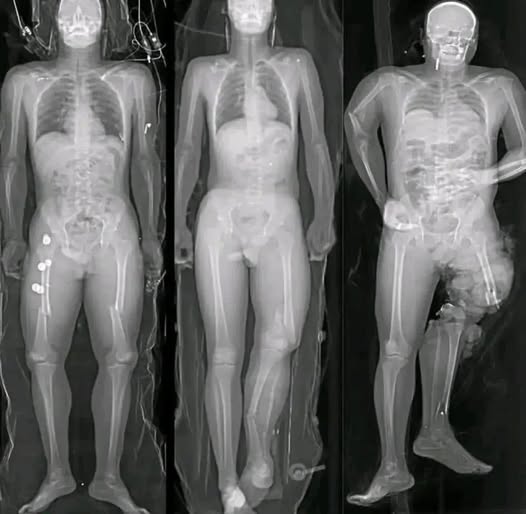 What You Should Understand If You Received the COVID Vaccine: Separating Facts From Viral Fear