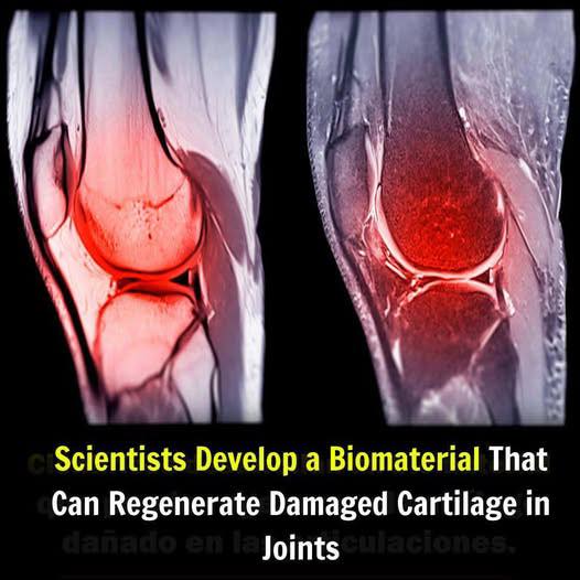 Innovative Biomaterial Offers Promise for Regenerating Cartilage in Damaged Joint