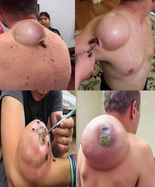 These Are The First Symptoms Of A…