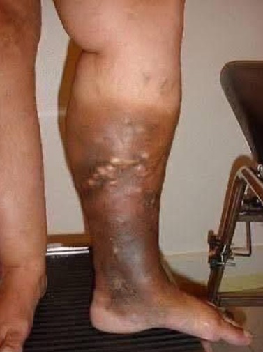 The Quiet Signals Our Bodies Send Long Before We Feel Unwell