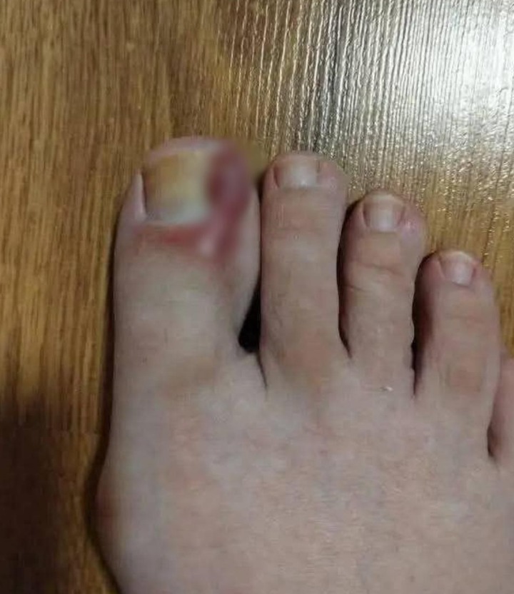 Signs on your FEET that indicate you are cr…See more