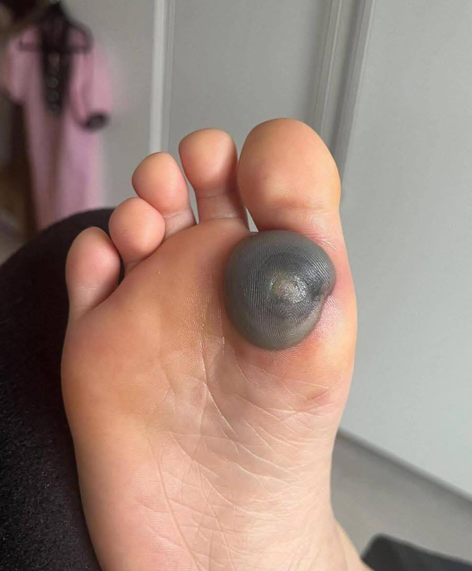 My daughter woke up with this huge spo