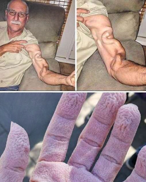 He Tried to Stretch, but Something Surprising Happened to His Arm