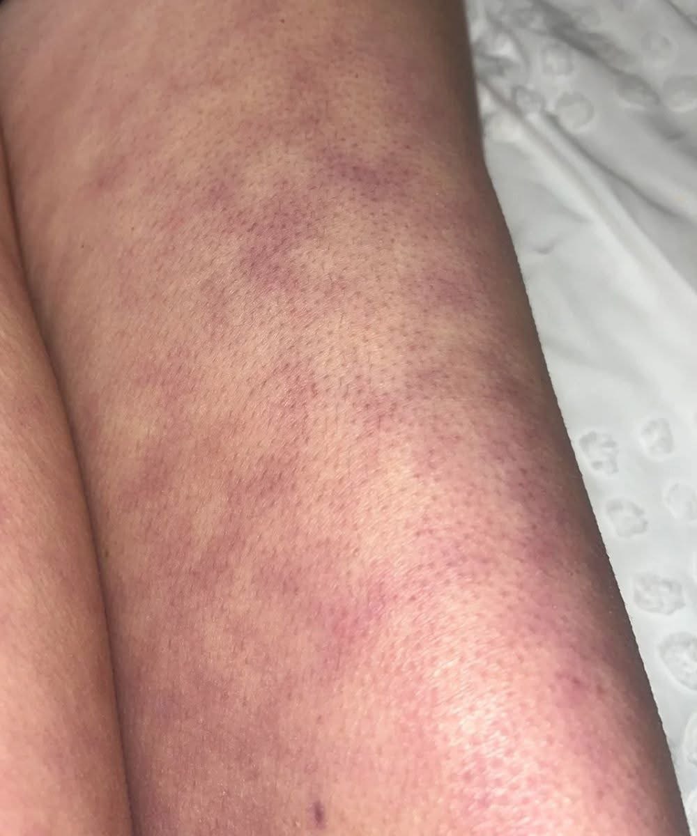 These are the consequences of sleeping with the… See moree