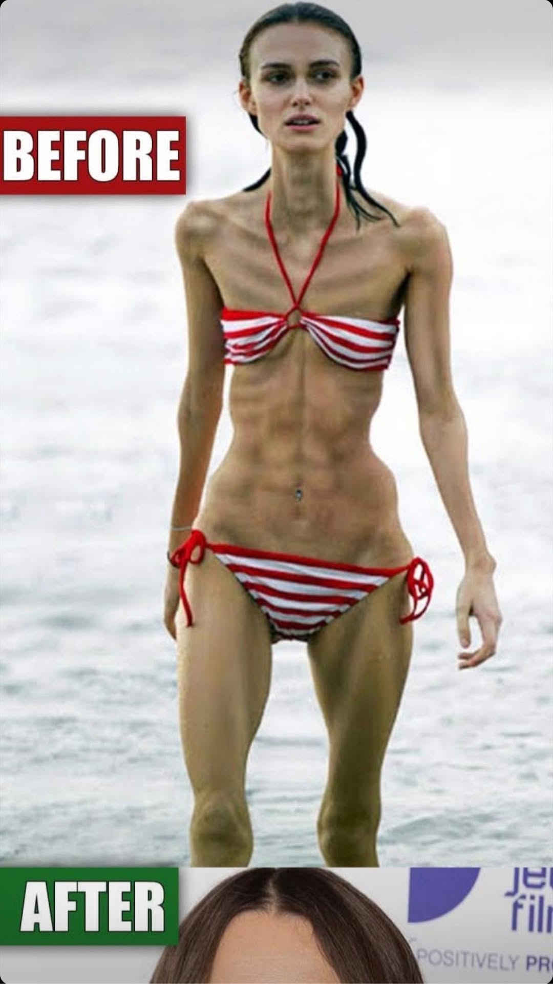 The Story a Single Image Tells: Body, Perception, and the Power of “Before and After”