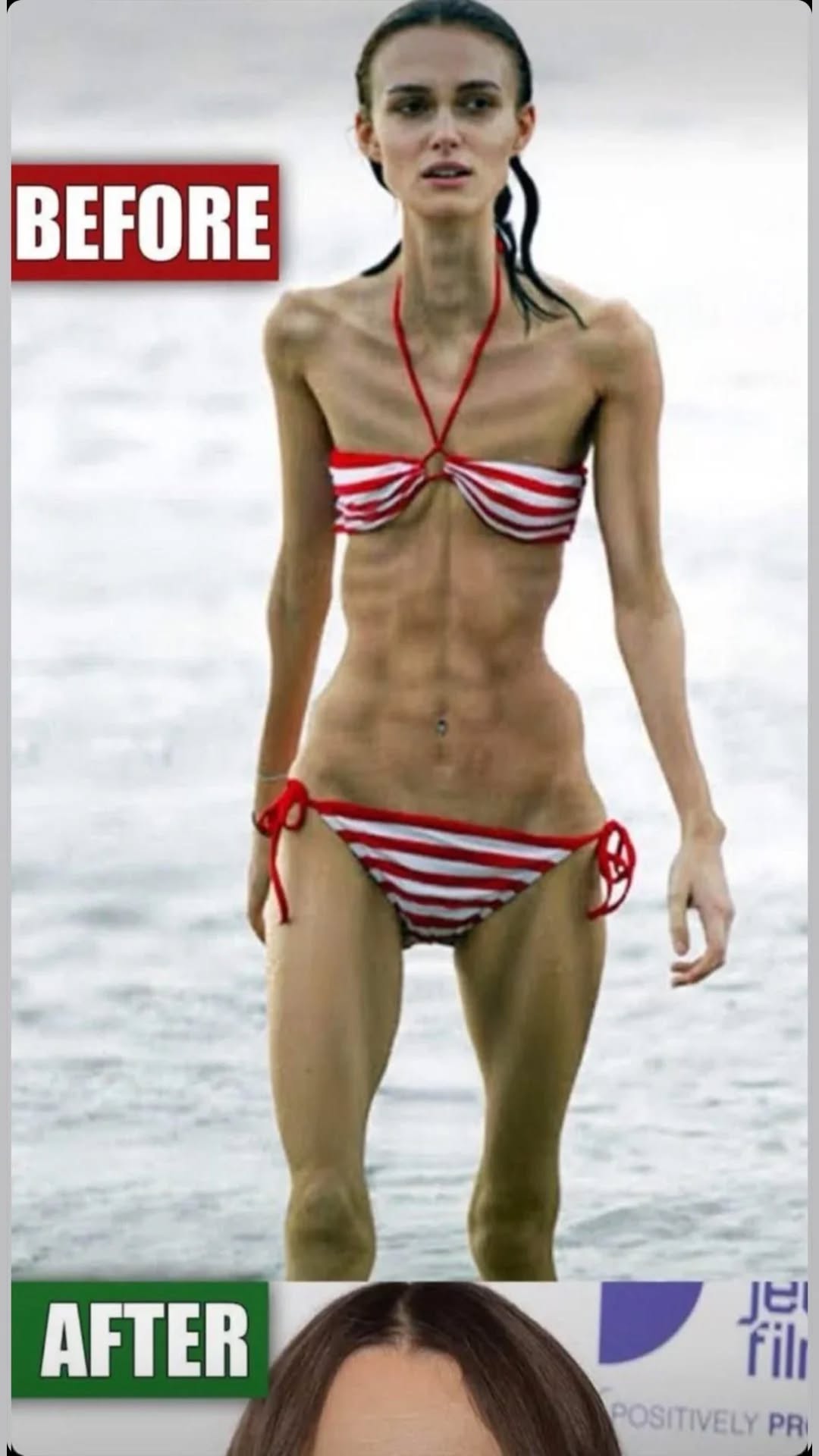 Anorexic woman at risk of dying after dropping to 5st looks incredible after weightlifting aids recovery