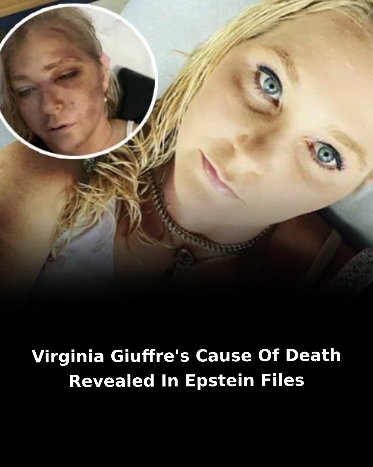 Virginia Giuffre’s cause of death accidentally revealed in Epstein files