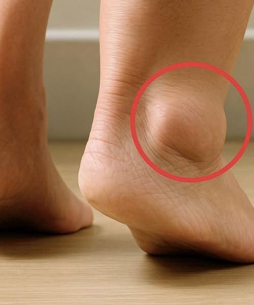 Understanding Swollen Feet in Seniors: Causes, Prevention, and Relief Strategies