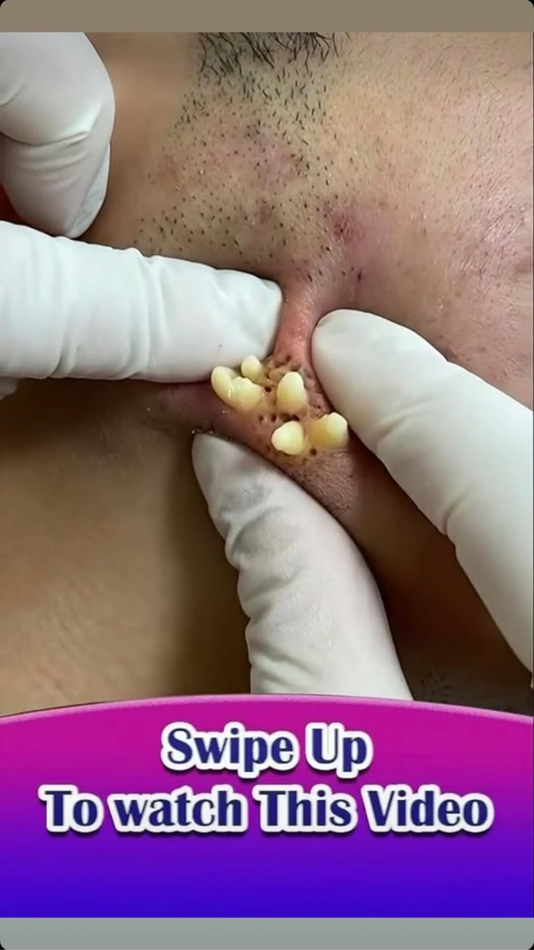 6 Warning Signs Your Thyroid Might Be in Trouble