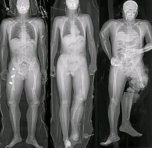 What you should know if you got the COVID vaccine: The truth behind these viral messages.