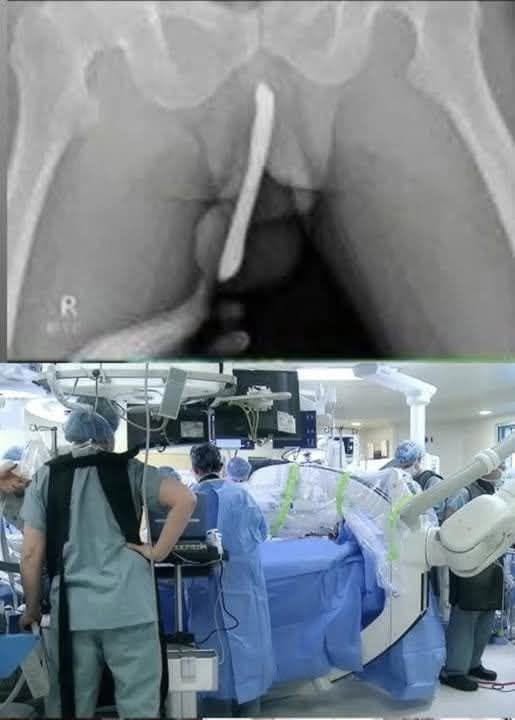 Teen Hospitalized After Dangerous Online Trend, Doctors Issue Urgent Warning