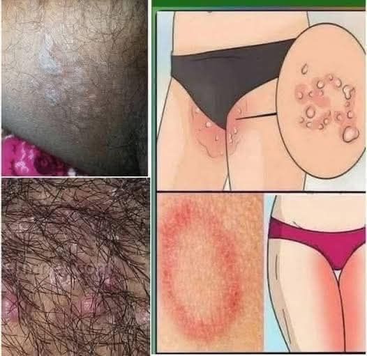 Early Signs Your Skin May Be Trying to Tell You Something: What to Watch For