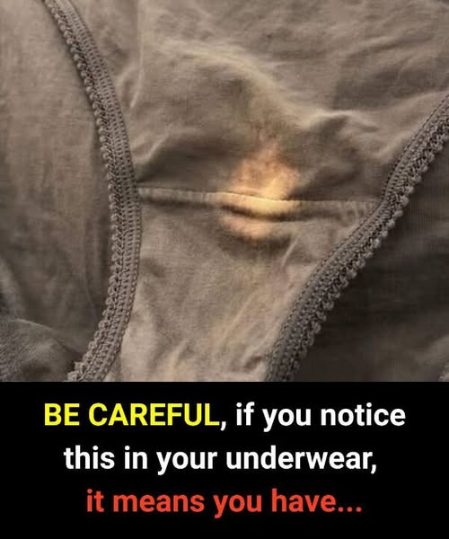 Understanding Underwear Discoloration: Normal Changes vs Health Warning Signs