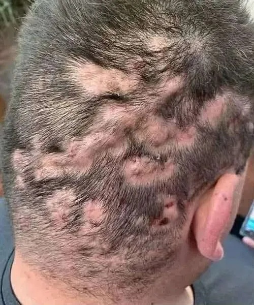 These are the first symptoms of cr…