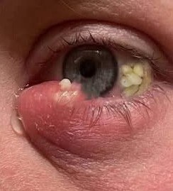 What Many People Notice After Trying This Unique Habit Is Surprising