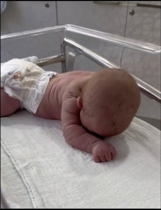 A Newborn’s First Surprise: The Remarkable Birth Story That Captivated the Internet