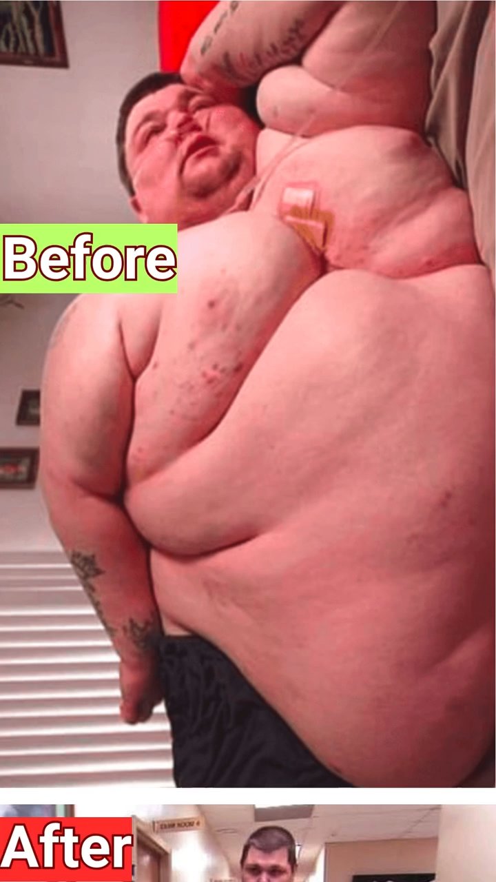 Man Once Weighing 727 Pounds Reclaims His Life After Remarkable Weight Loss Journey