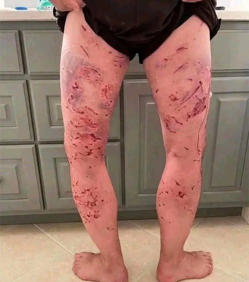 These are the consequences of sleep!ng with the… See more