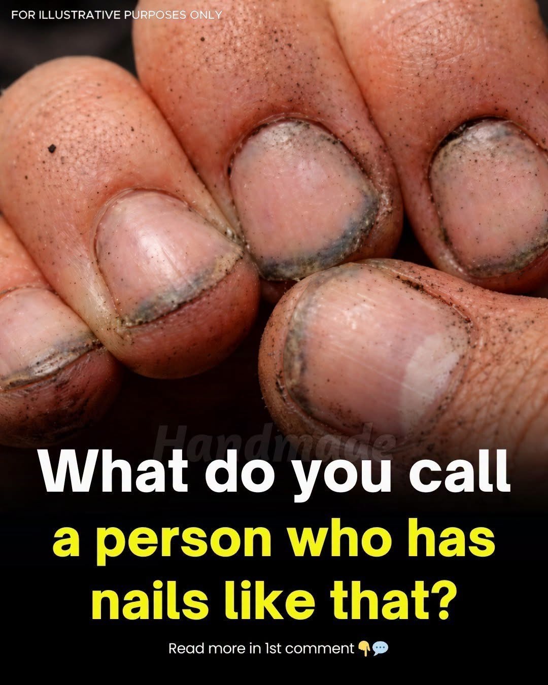 What Dirty Fingernails Really Reveal