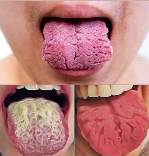 Listening to Your Body: What Tongue Changes Can Say About Overall Well-Being